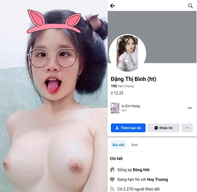 Sex Đặng Thị Bình mặt baby